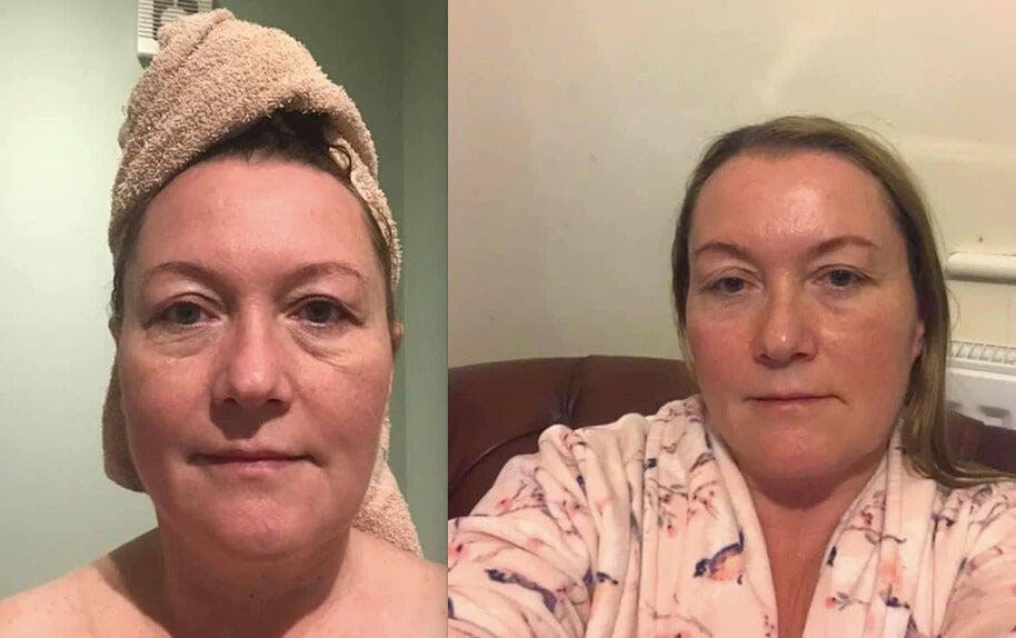 Anti-Aging Light Therapy Mask