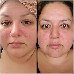 Anti-Aging Light Therapy Mask