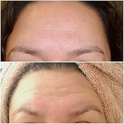 Anti-Aging Light Therapy Mask